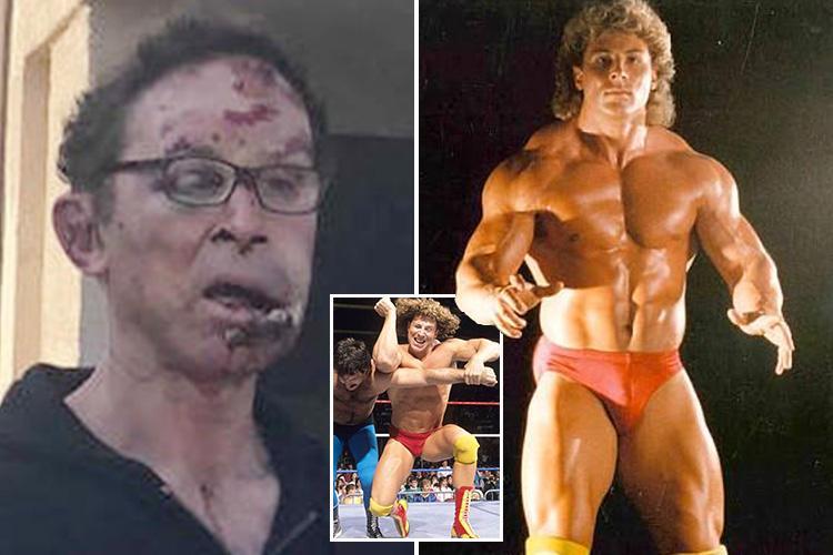 Former WWE Wrestler nearly beat to death on a parking spot